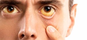 Приходи с друзьями: возле одесского вокзала бесплатно протестируют на гепатиты 