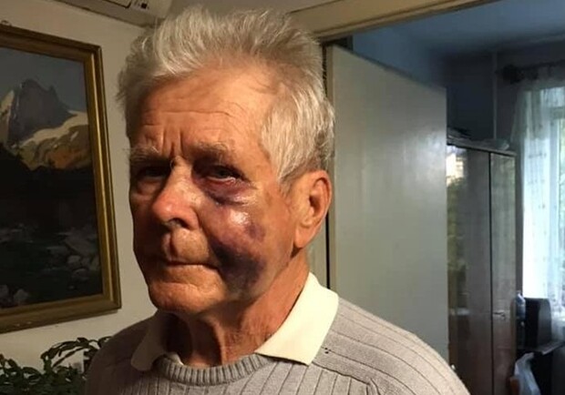 Как чувствует себя пенсионер, которого избил маршрутчик. Фото: fb Ольга Воробей