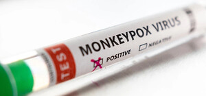 Дойдет ли вирус оспы обезьян в Украину: ответ Минздрава