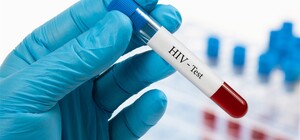 В Украине запустили чат-бот, что поможет оценить риск заболеть ВИЧ