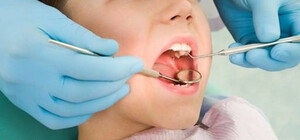 В детских стоматологических отделениях Одессы можно будет бесплатно проверить зубы: где и когда