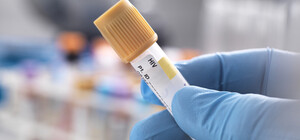 В Киеве девушку уволили с работы из-за ВИЧ-положительного статуса