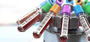 В Харьковской области все чаще болеют вирусным гепатитом