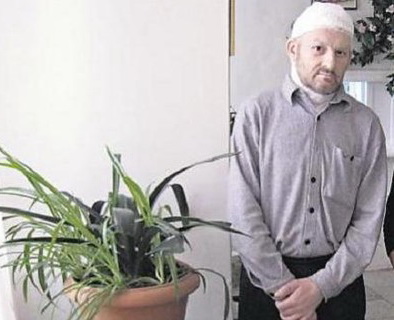Сотрудник Киевского зоопарка, которого разодрал тигр, мечтает вернуться на работу. Фото: А. Искрицкой, segodnya.ua
