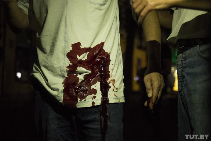 Раненый во время протестов в Бресте. Источник фото: tut.by